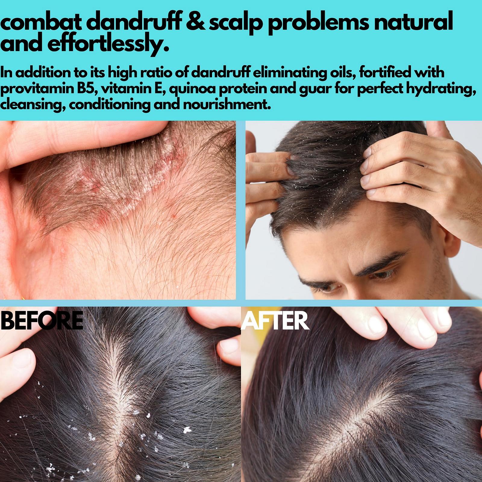 Брусок шампуня Kirei Anti Dandruff 2-в-1 для жирной или сухой перхоти Авокадо/Можжевельник/Розмарин 100 г, фото №5