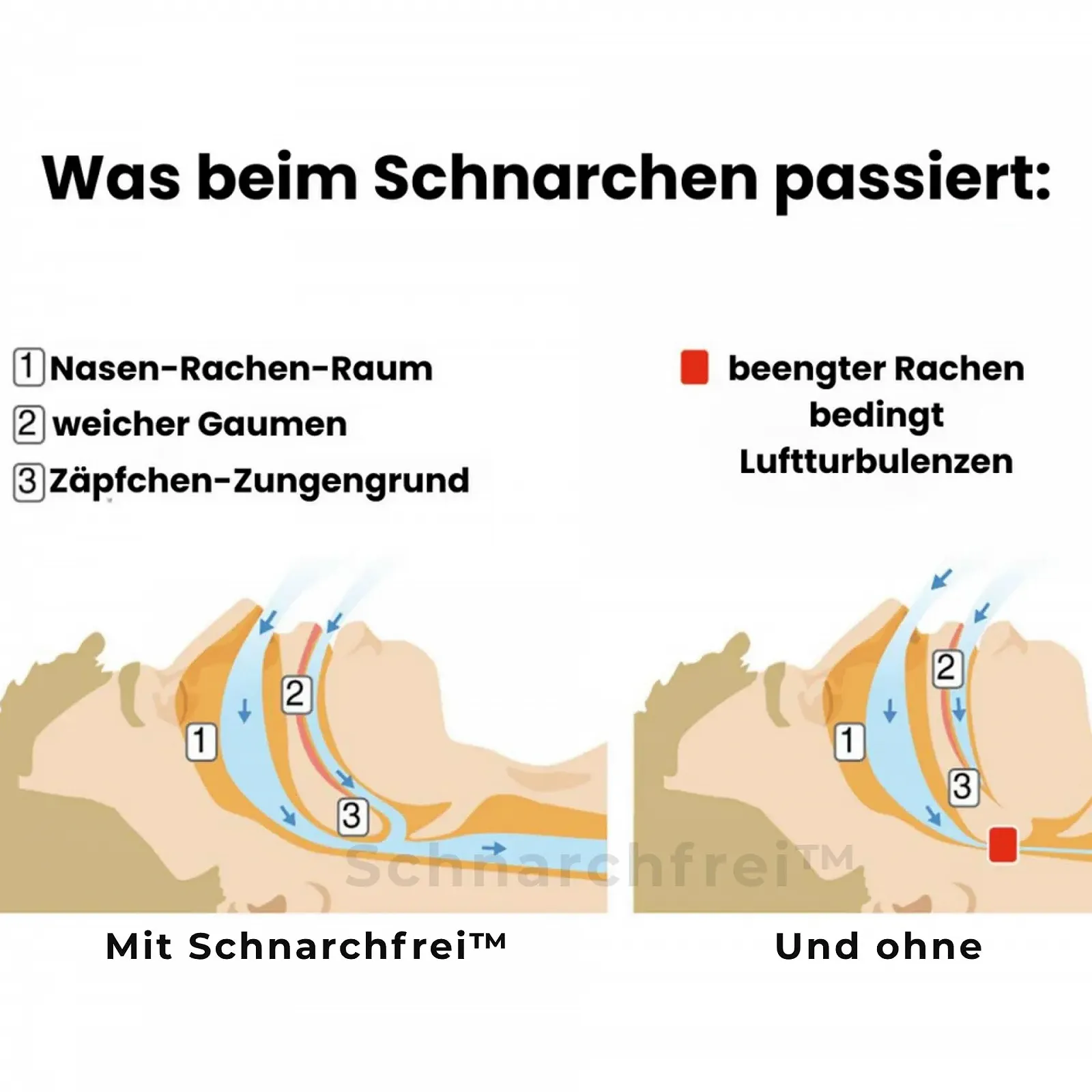 Ротовий Апарат Проти Хропіння Pomera Snoring Free Nuraya Ефективний Засіб для Спокійного Сну, фото №3