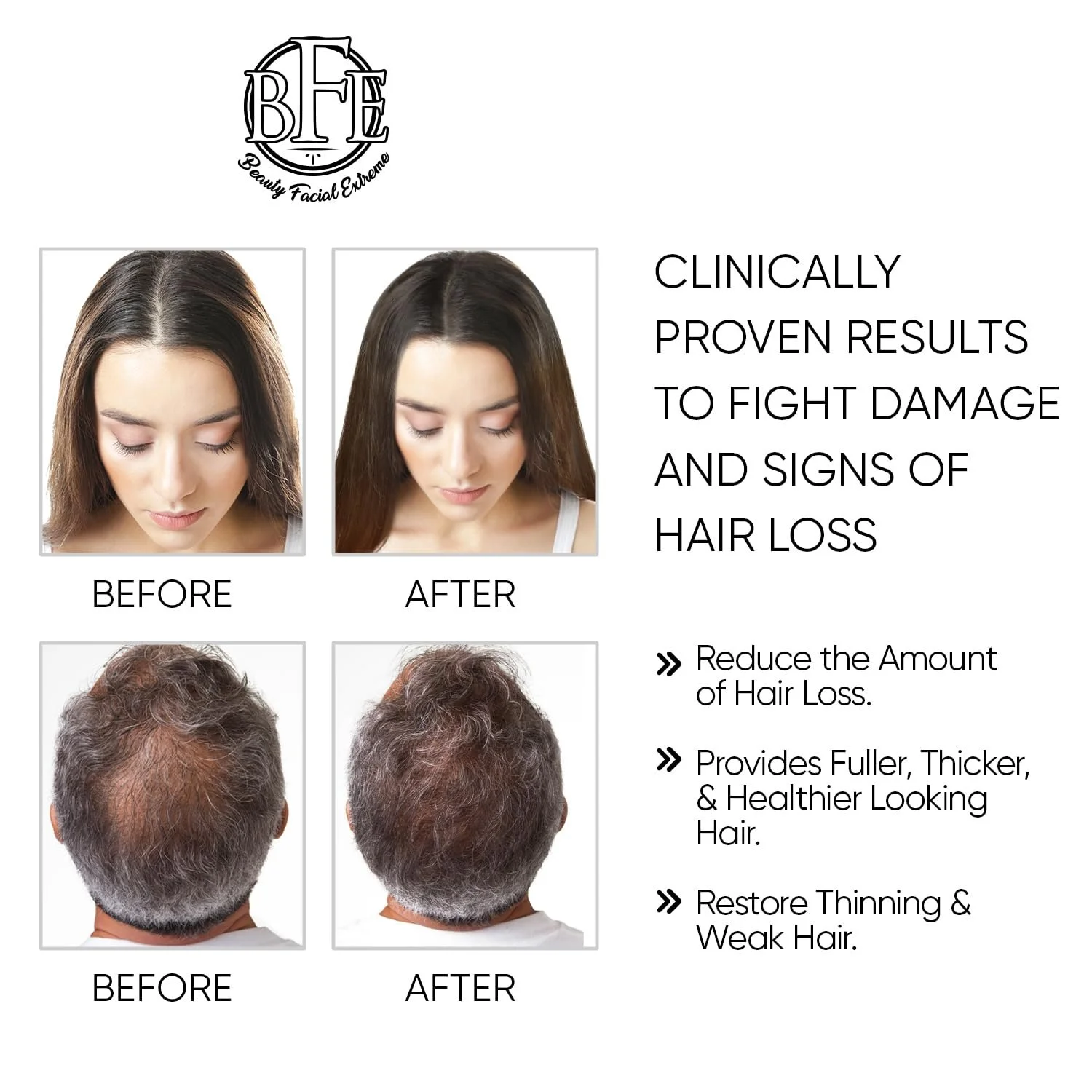 Сироватка для росту волосся Beauty Facial Extreme Maximum Strength DHT Blocker для чоловіків і жінок, фото №4