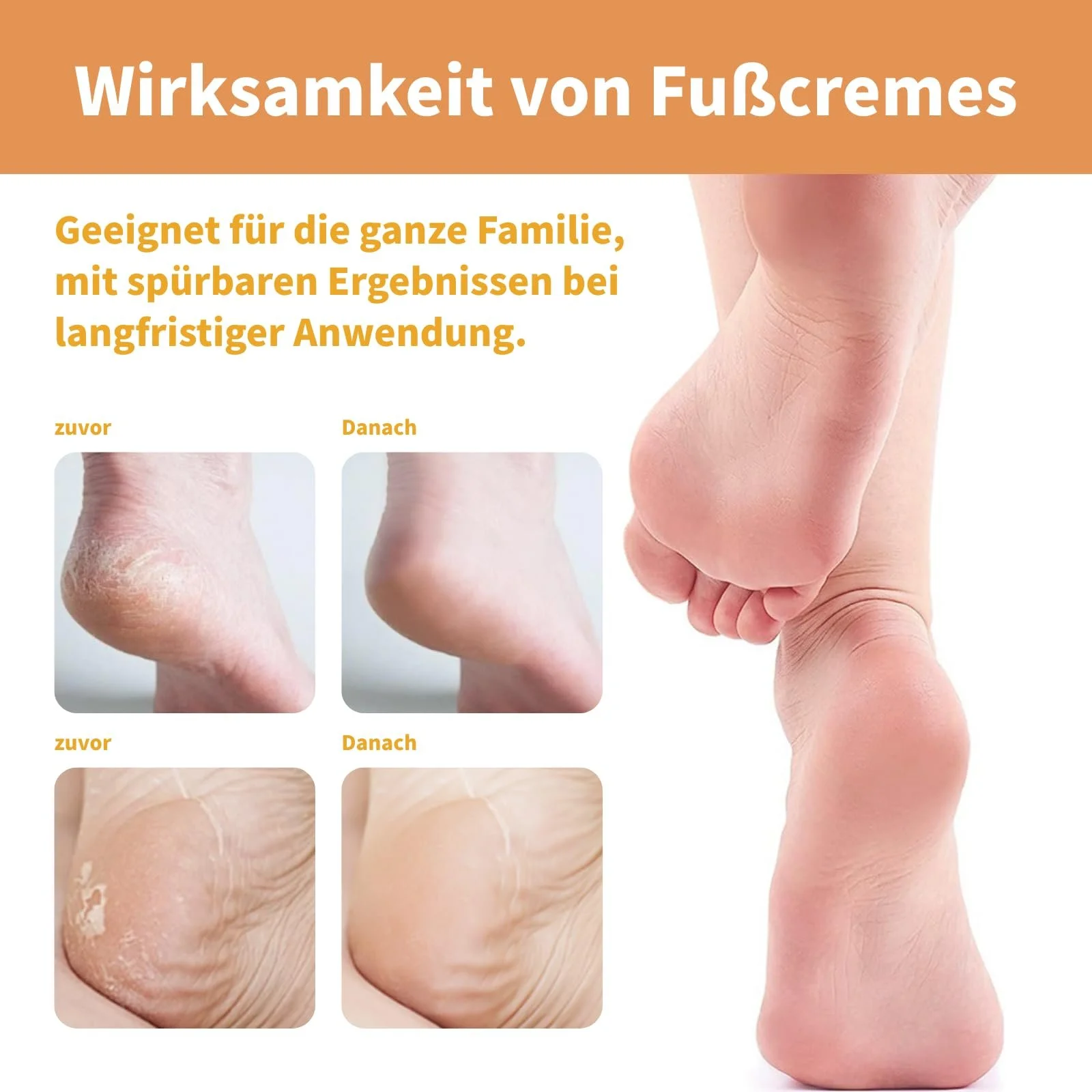 Крем для ног Urea 60% увлажняющий против трещин 2 шт., фото №7 Крем для ног Urea 60% увлажняющий против трещин 2 шт., фото №7