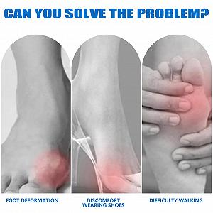 Коректор великого пальця стопи 1 пара для жінок та чоловіків, регульований зручний для лівої та правої ноги, полегшення болю Hallux Valgus synthetic.ua - Фото 1