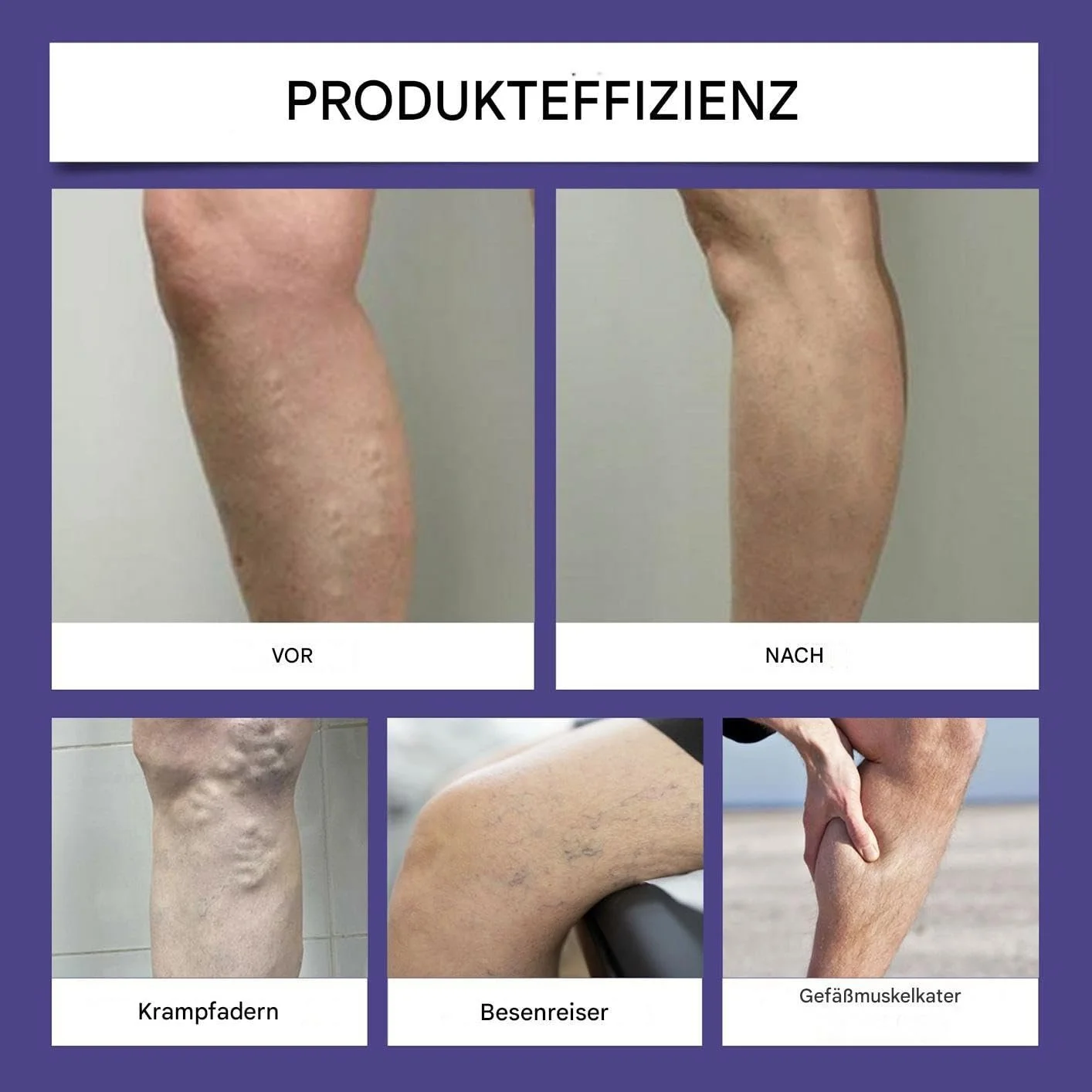 Олівець для видалення судинних зірочок Spider Vein Removal Pen бездротовий, фото №5