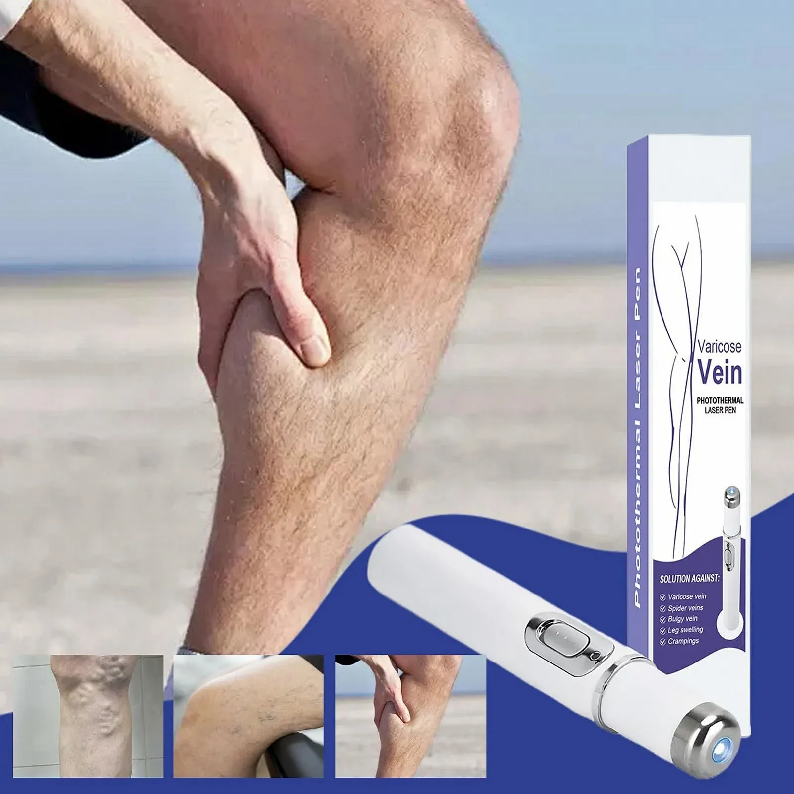 Прибор для удаления сосудистых сеточек Wireless Vein Care Pen беспроводной, фото №3