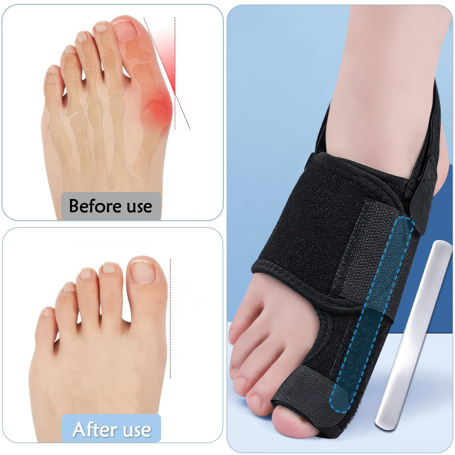 Коректор великого пальця стопи з алюмінієвою шиною для чоловіків та жінок, 1 пара, фото №4