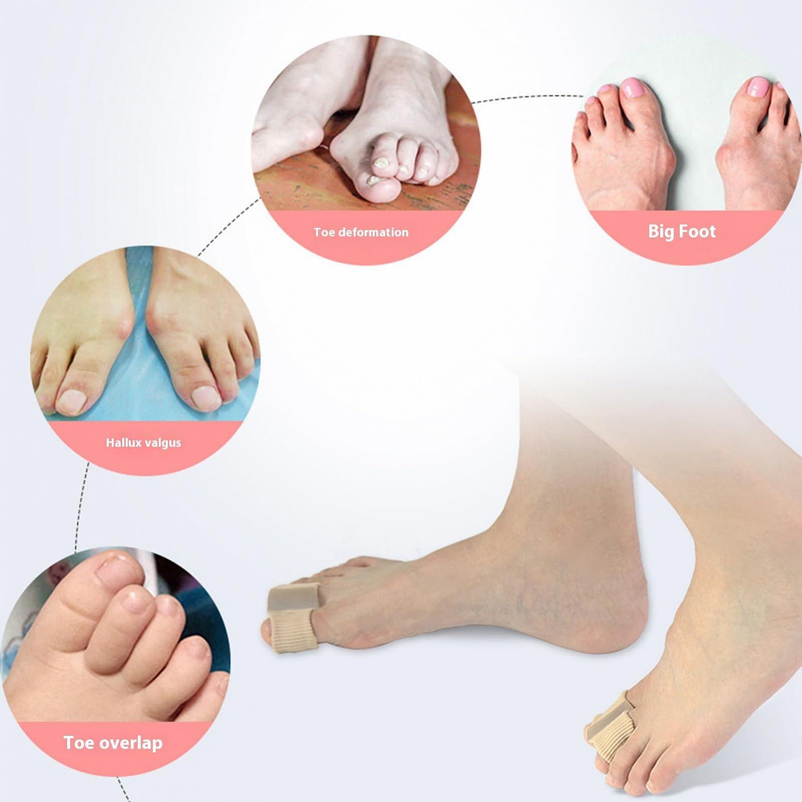 Разделитель для пальцев Valgus, для воспаленных косточек большого пальца, противоскользящий, двойное кольцо, перекрывающие пальцы, Hallux valgus, устройство для облегчения боли, комфортная боль в ногах, 4 шт., S, фото №2