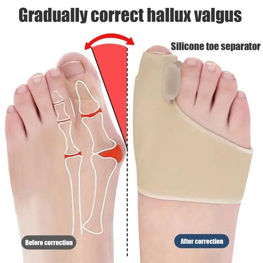 Корректор большого пальца стопы Hallux Valgus Большой (41-45) Кожаный цвет, 1 пара, фото №7