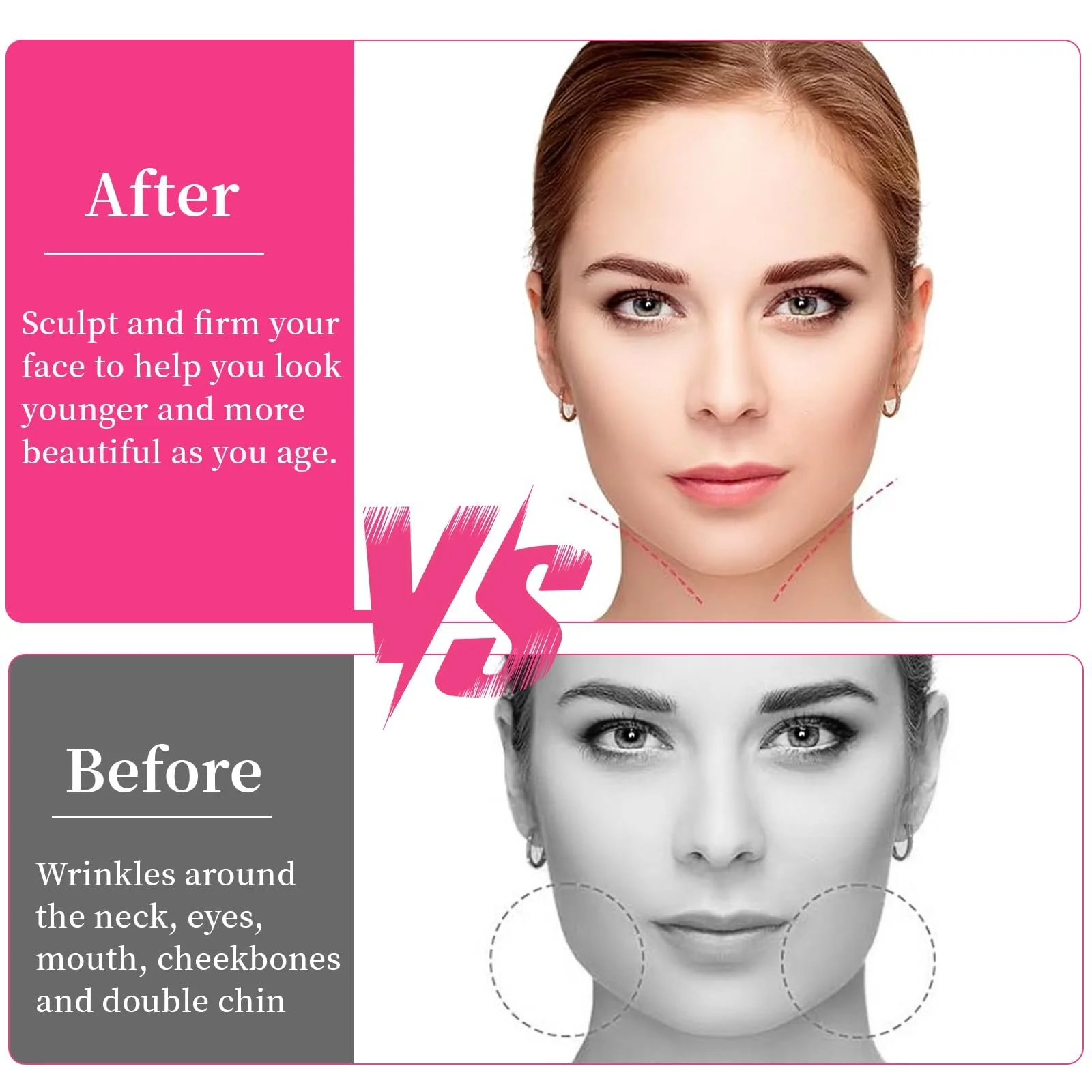 Ленты для подтяжки лица (160 шт.), фото №5