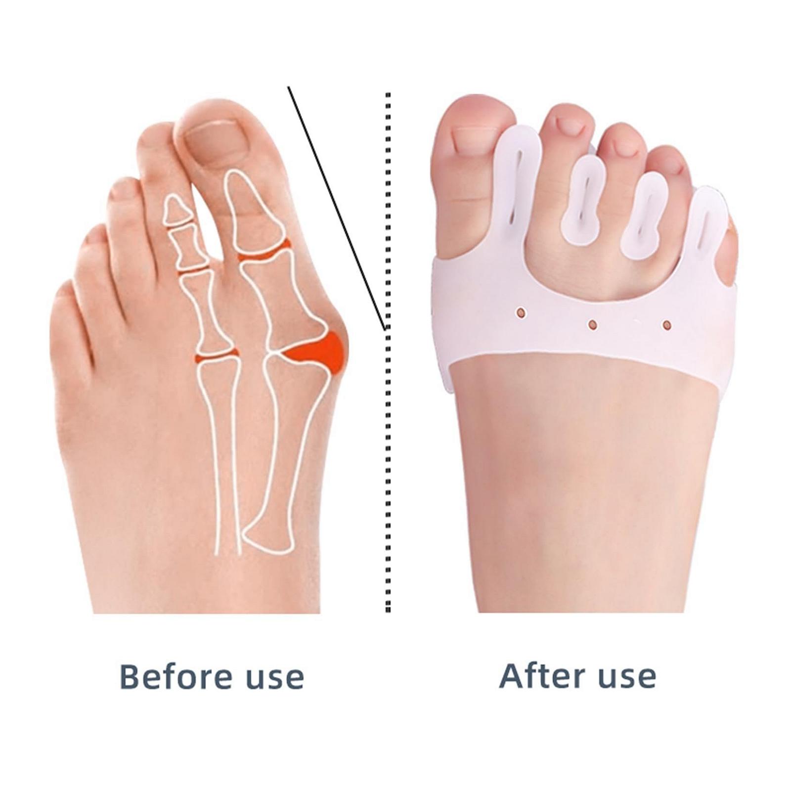 Роздільник для пальців ніг JHTSOLE, плюсневі подушечки, фото №5 Роздільник для пальців ніг JHTSOLE, плюсневі подушечки, фото №5