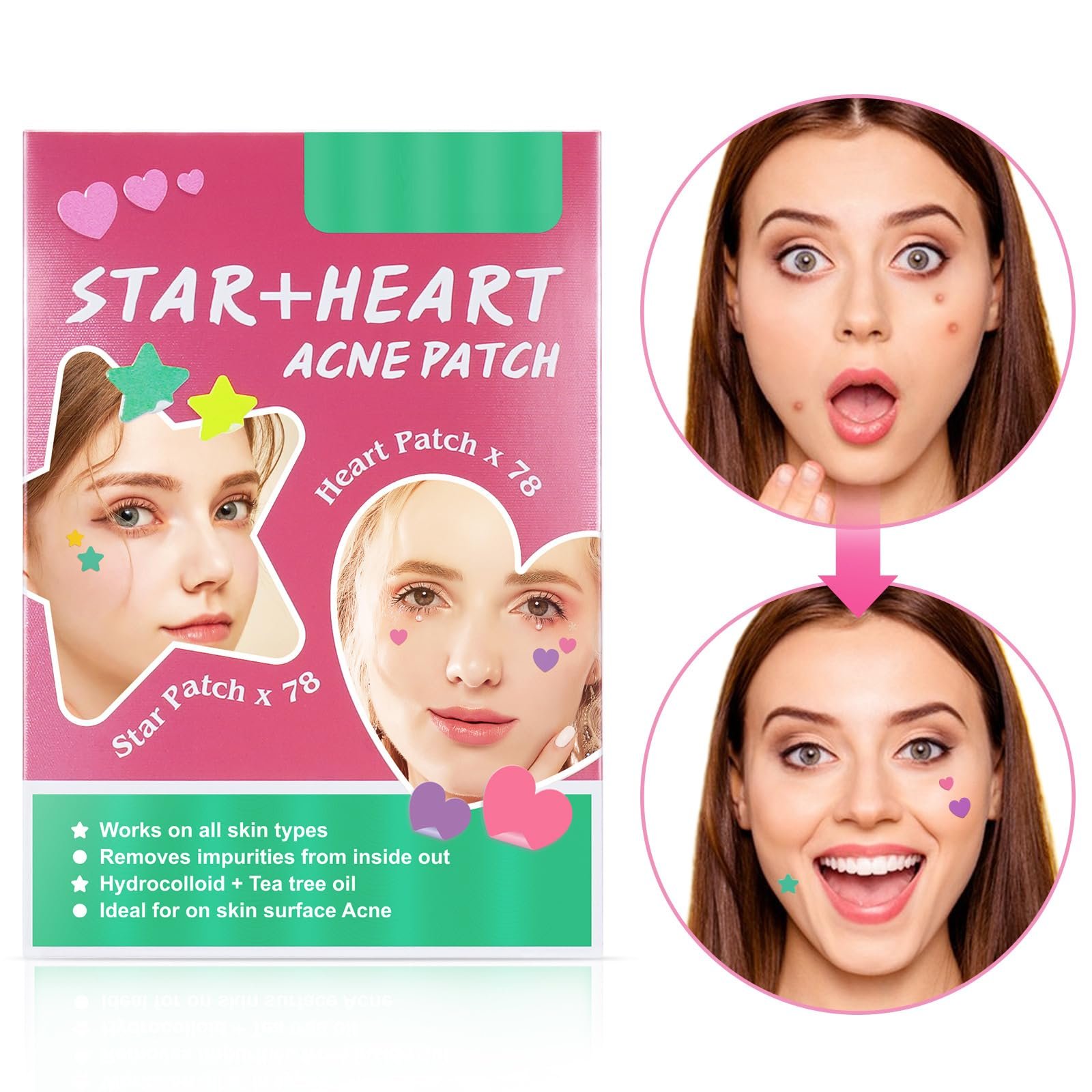 Патчи от прыщей Tkekruh, утолщенные, пластырь от акне, эффективный против акне и прыщей, фото №7