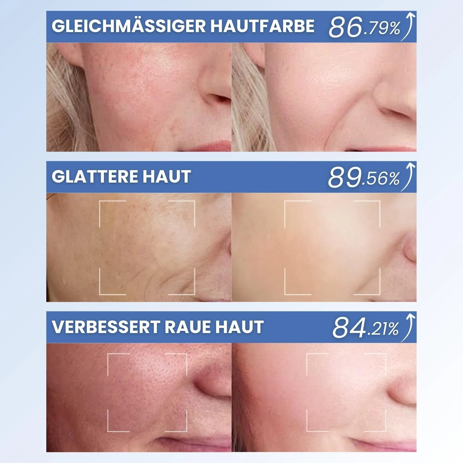 Маска для обличчя для розгладження та омолодження, фото №7