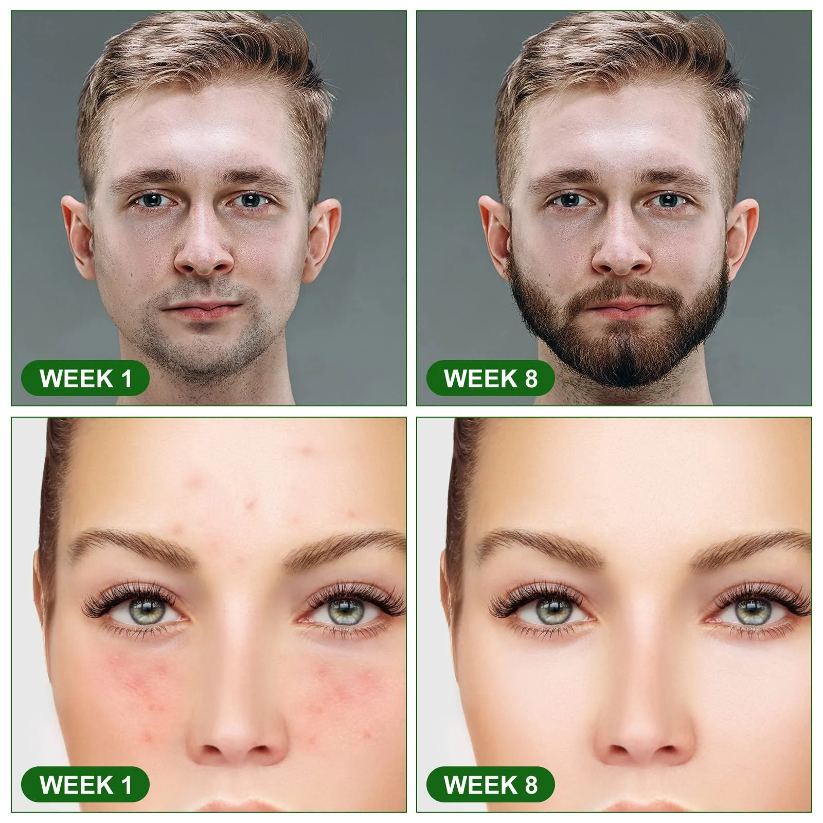 Дермаролер URAQT, ролик з мікроголками для обличчя та тіла, ролик для росту бороди, фото №6