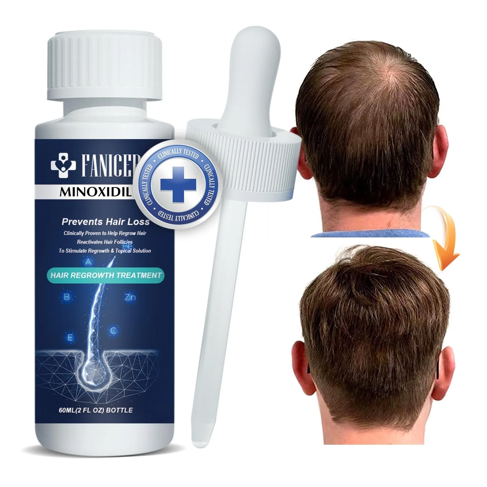 Засіб для росту волосся Натуральний 60 мл для чоловіків і жінок, фото №1