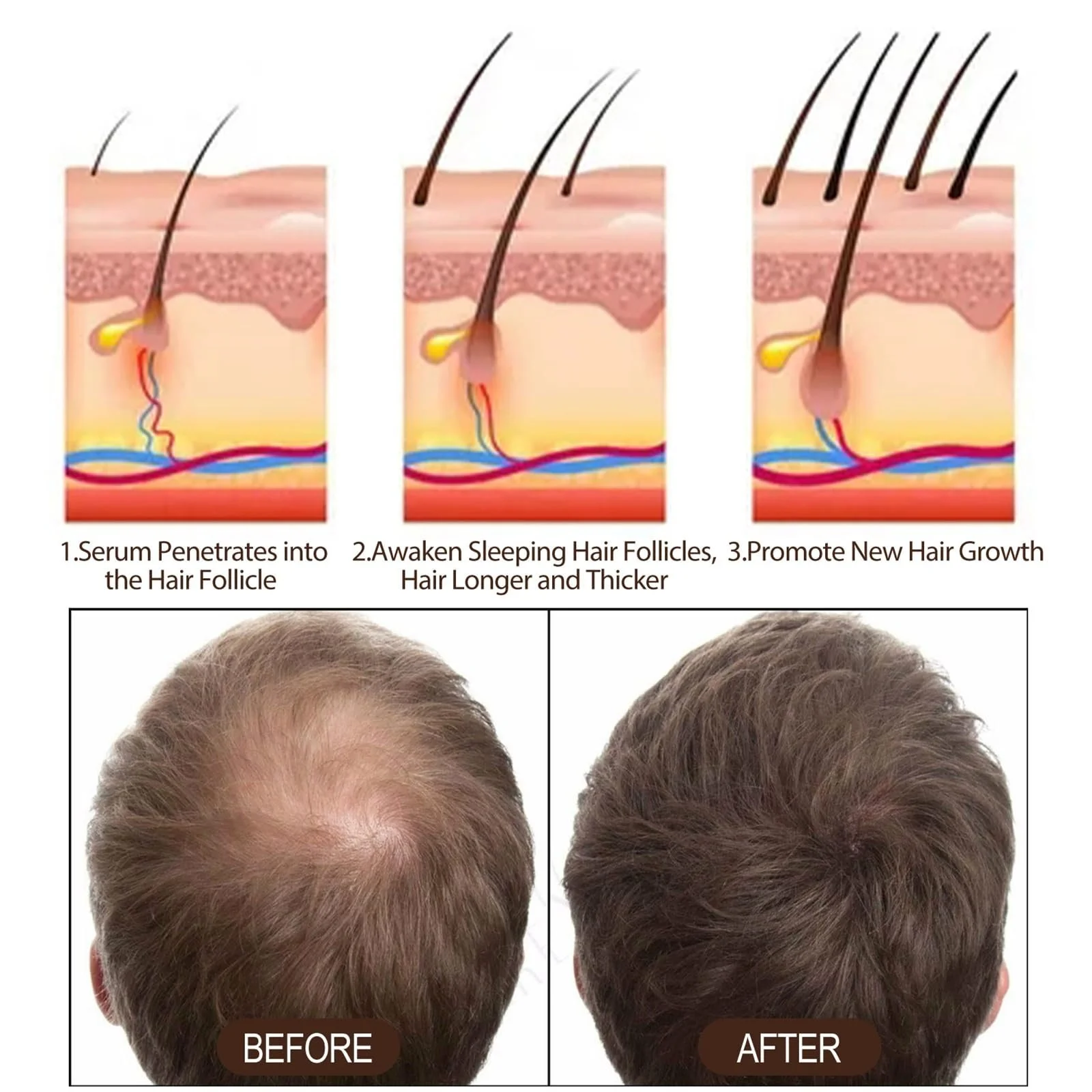 Сироватка для догляду за волоссям, 2 шт. Сироватка проти випадіння волосся, фото №4 Сироватка для догляду за волоссям, 2 шт. Сироватка проти випадіння волосся, фото №4