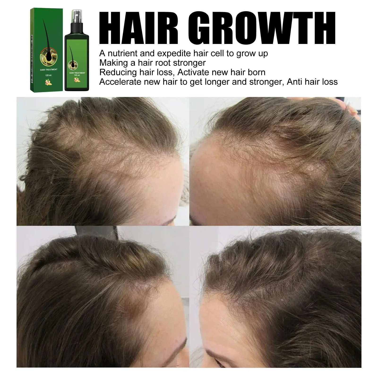 Спрей Ginger Care, фото №4