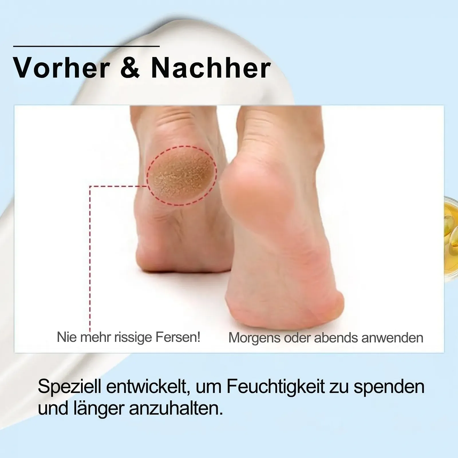 Крем для ног и рук с мочевиной 50% 100 г, фото №2