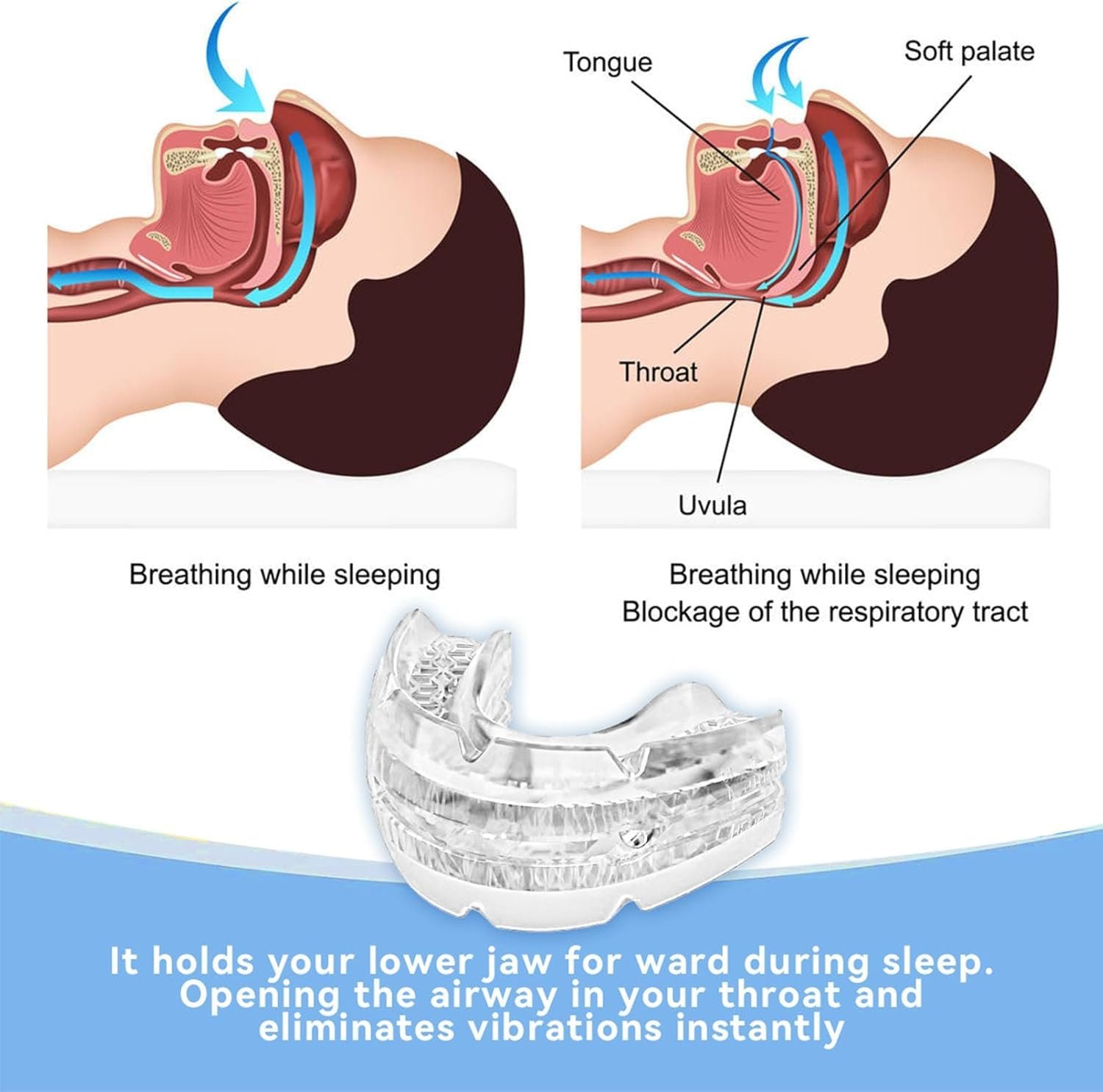 Средство от храпа: Шина, фото №2