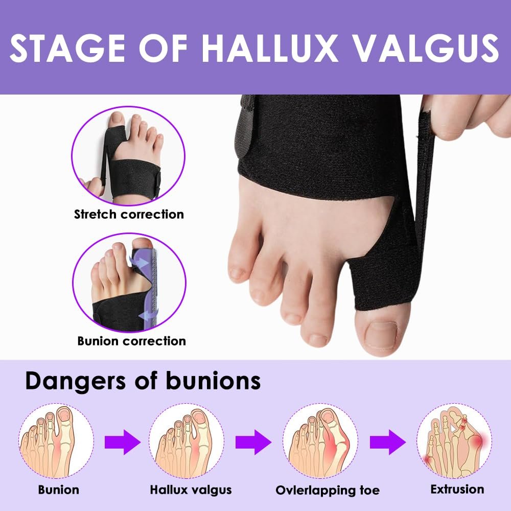 Шина для корекції Hallux Valgus Регульована, фото №4