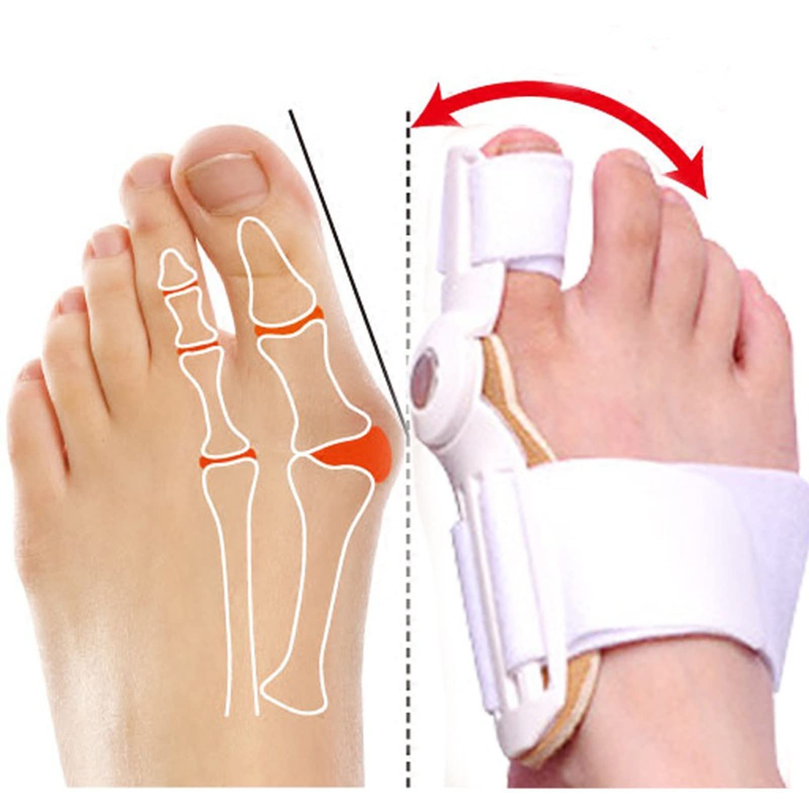 Коректор великого пальця стопи 2 шт Hallux Valgus Регульований Випрямляч, фото №2
