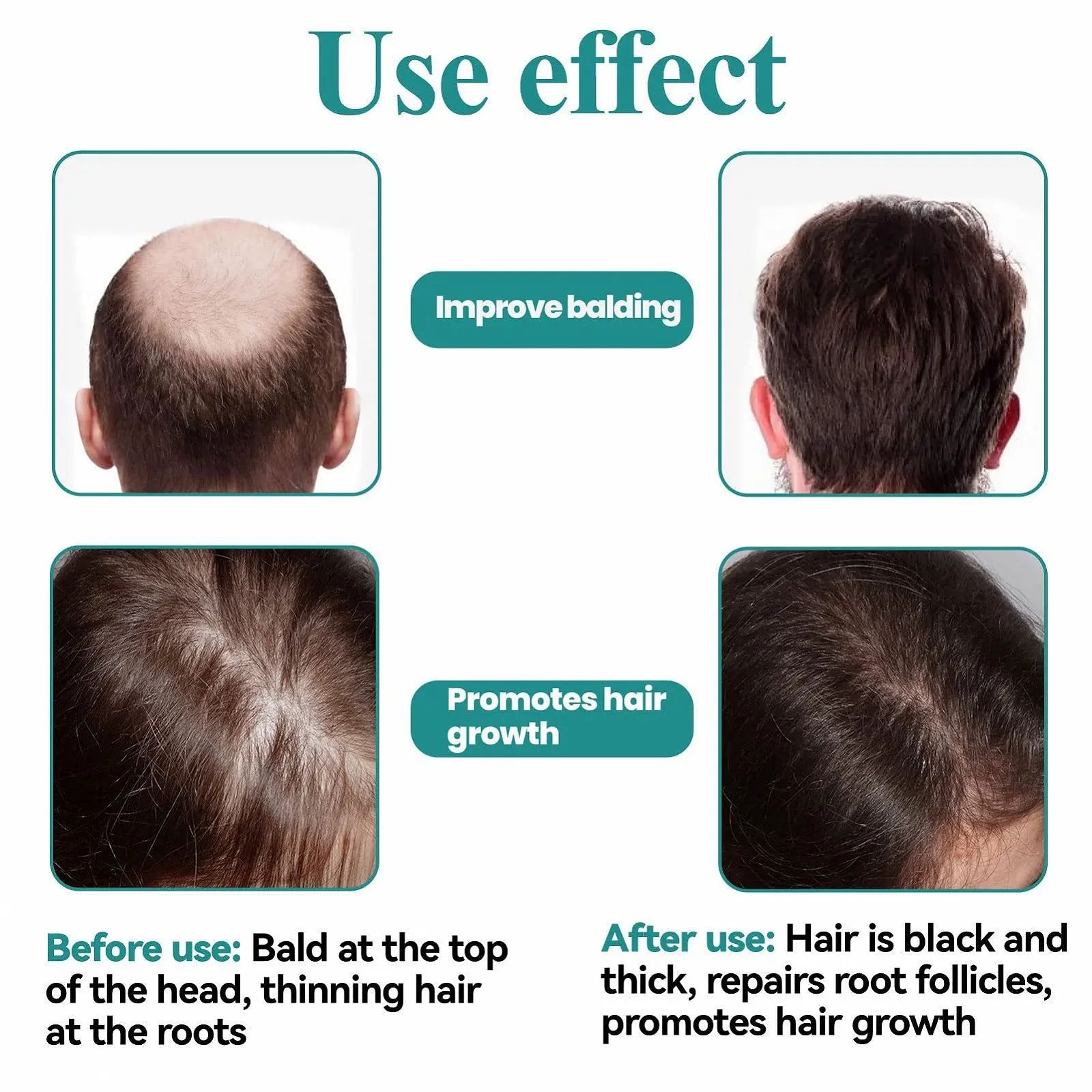 Сироватка для росту волосся 45 мл Зволожуюча Відновлює волосся Стимулює фолікули, фото №7 Сироватка для росту волосся 45 мл Зволожуюча Відновлює волосся Стимулює фолікули, фото №7