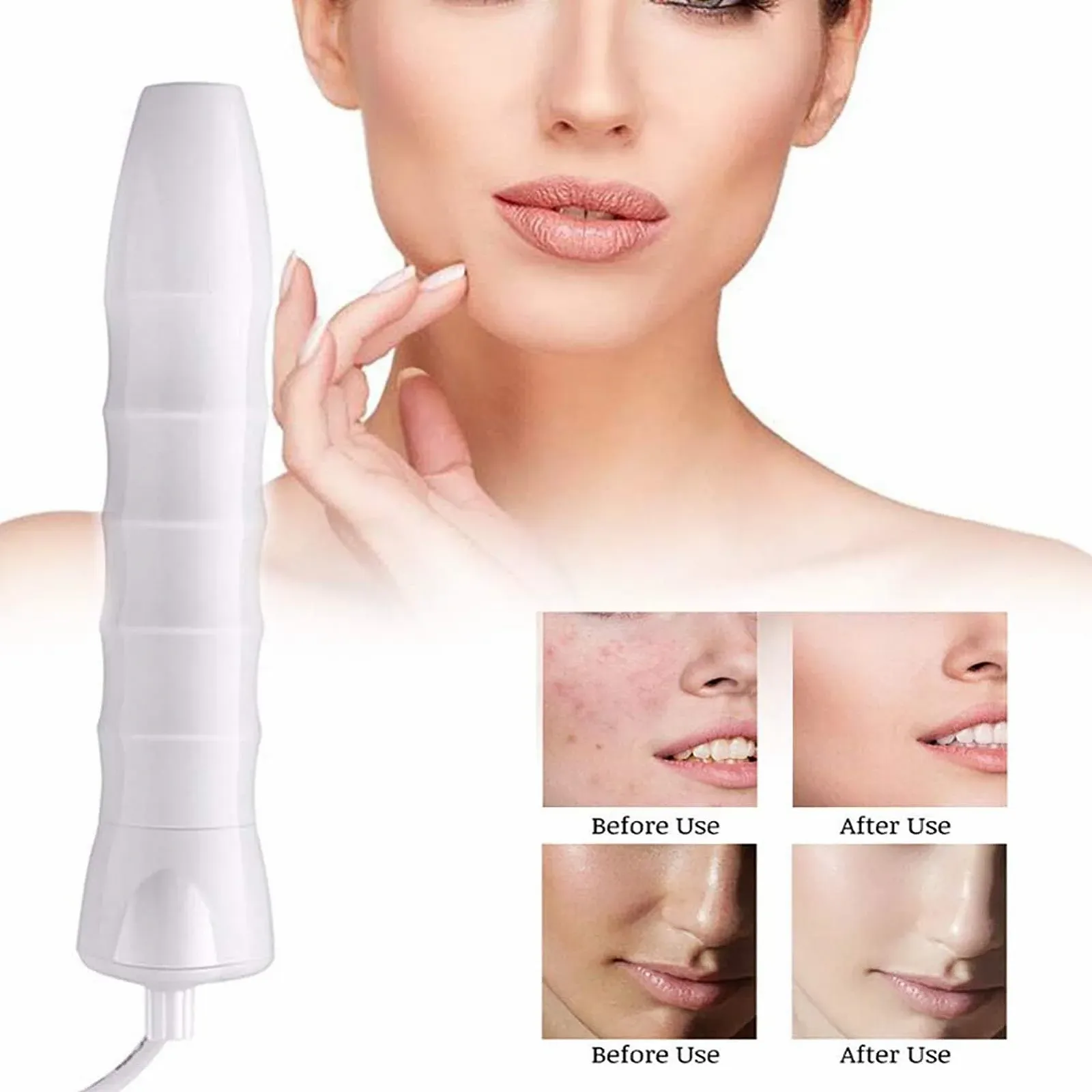 Портативний апарат дарсонваль KingSaid для обличчя та волосся з 4 електродами, фото №7