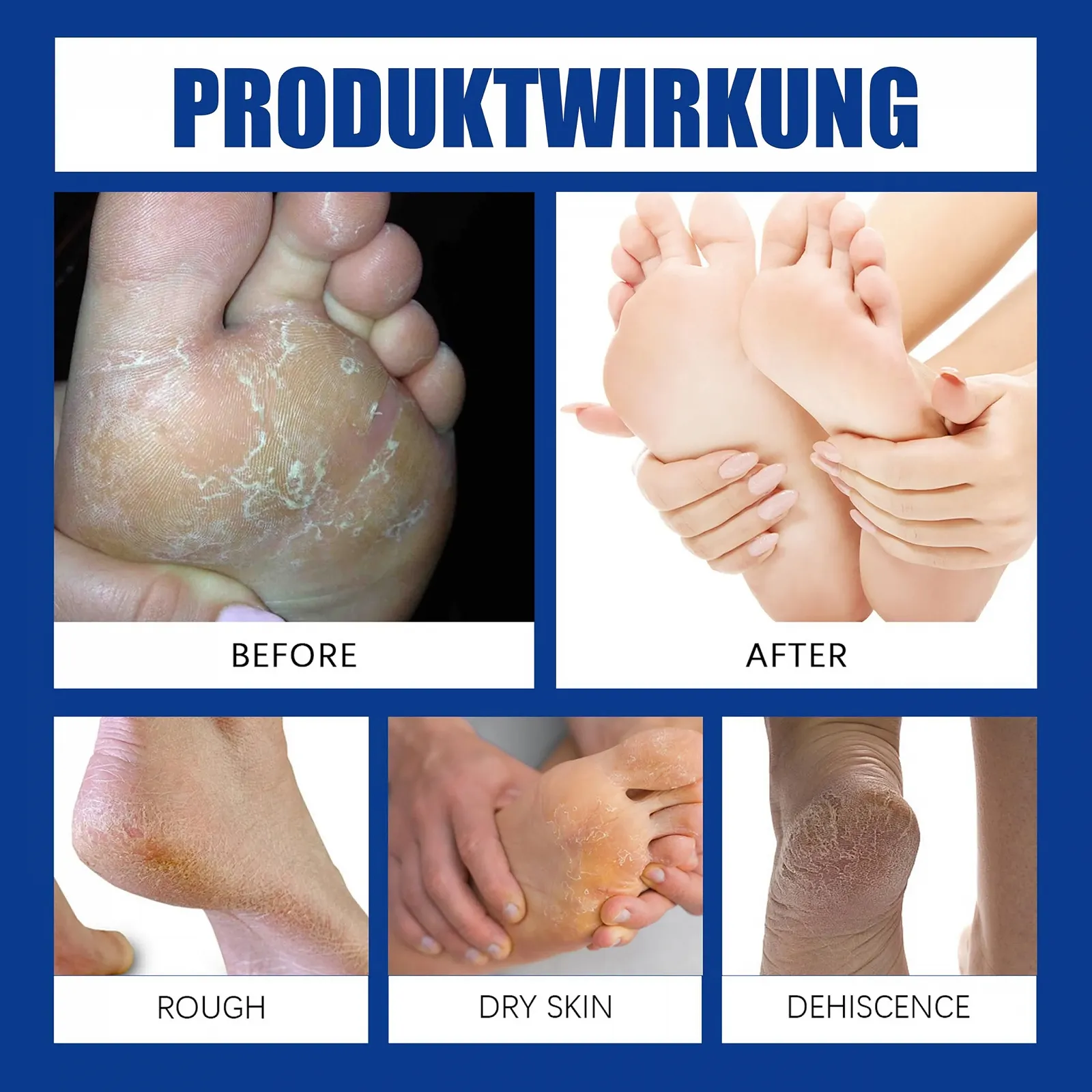 Набор крем для ног и масло для ногтей 60% Urea Anti-Cracking 300 мл AloeVera, фото №3