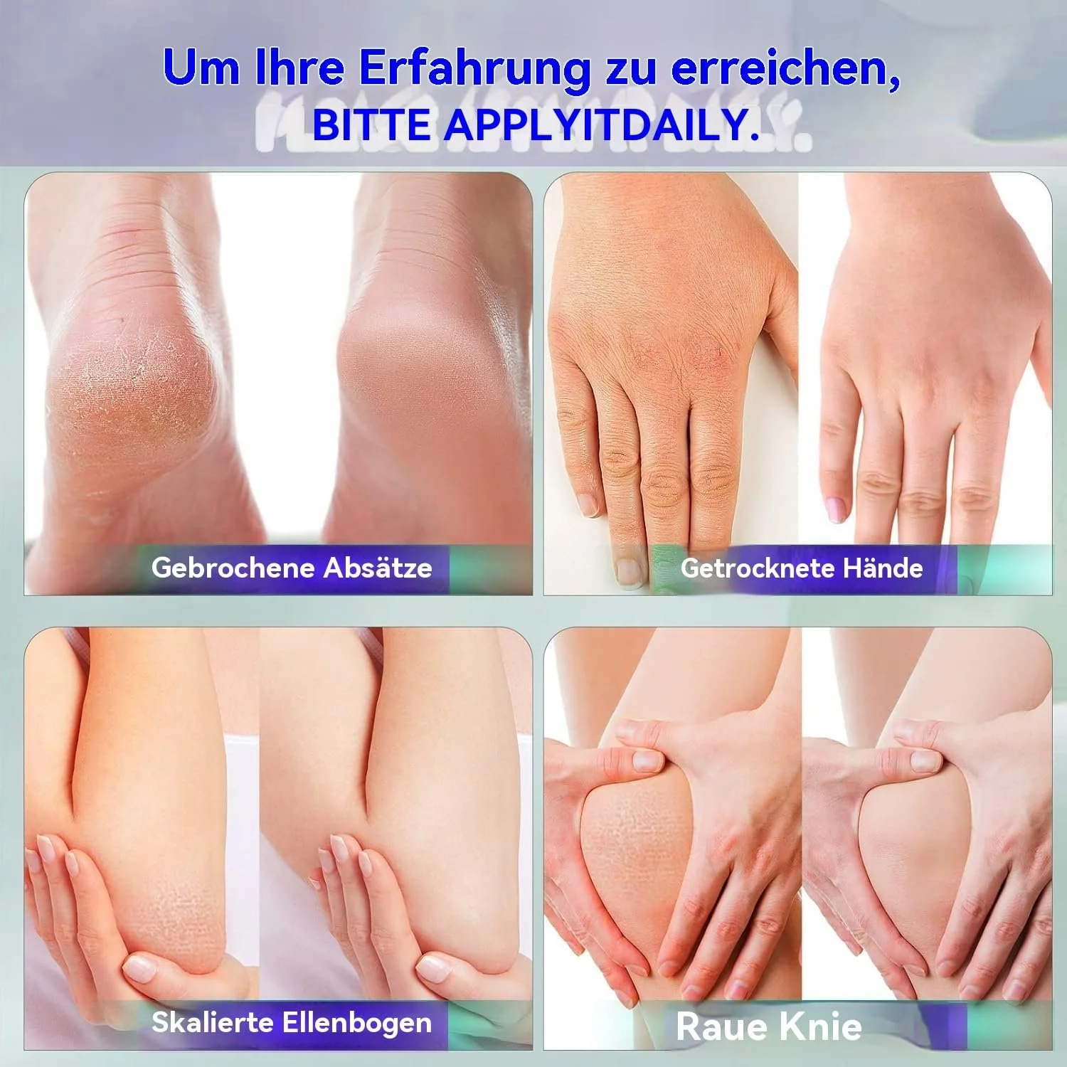 Крем для ног с 42% мочевиной и 2% салициловой кислотой 150 г (5.29 oz) Для сухих пяток и мозолей, фото №5