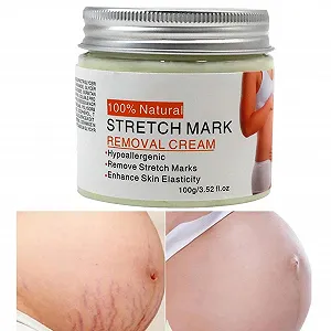 Крем от растяжек Belly Mark, 100 г, быстро впитывающийся выпрямляющий раствор, увлажняющий для беременных, для путешествий, бизнеса, дома, ежедневного использования, в помещении и - Фото 1
