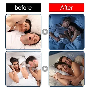 Смужка для рота Noctivo проти апное сну Лаванда Зручна synthetic.ua - Фото 1