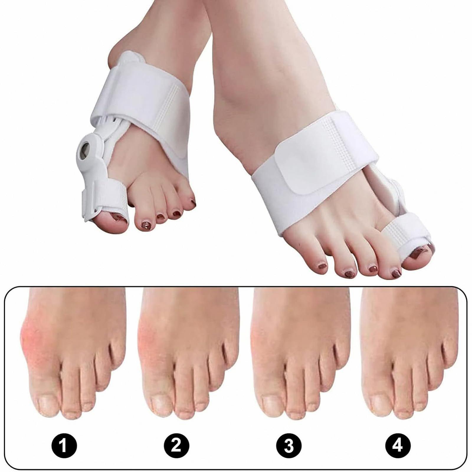 Шина для корекції великого пальця стопи Zehenglätter Для вальгусної деформації, 2 шт, фото №7
