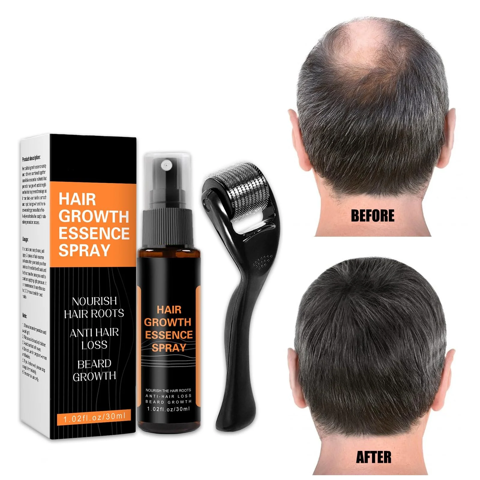 Есенція для росту волосся Спрей проти випадіння волосся, фото №1 Есенція для росту волосся Спрей проти випадіння волосся, фото №1