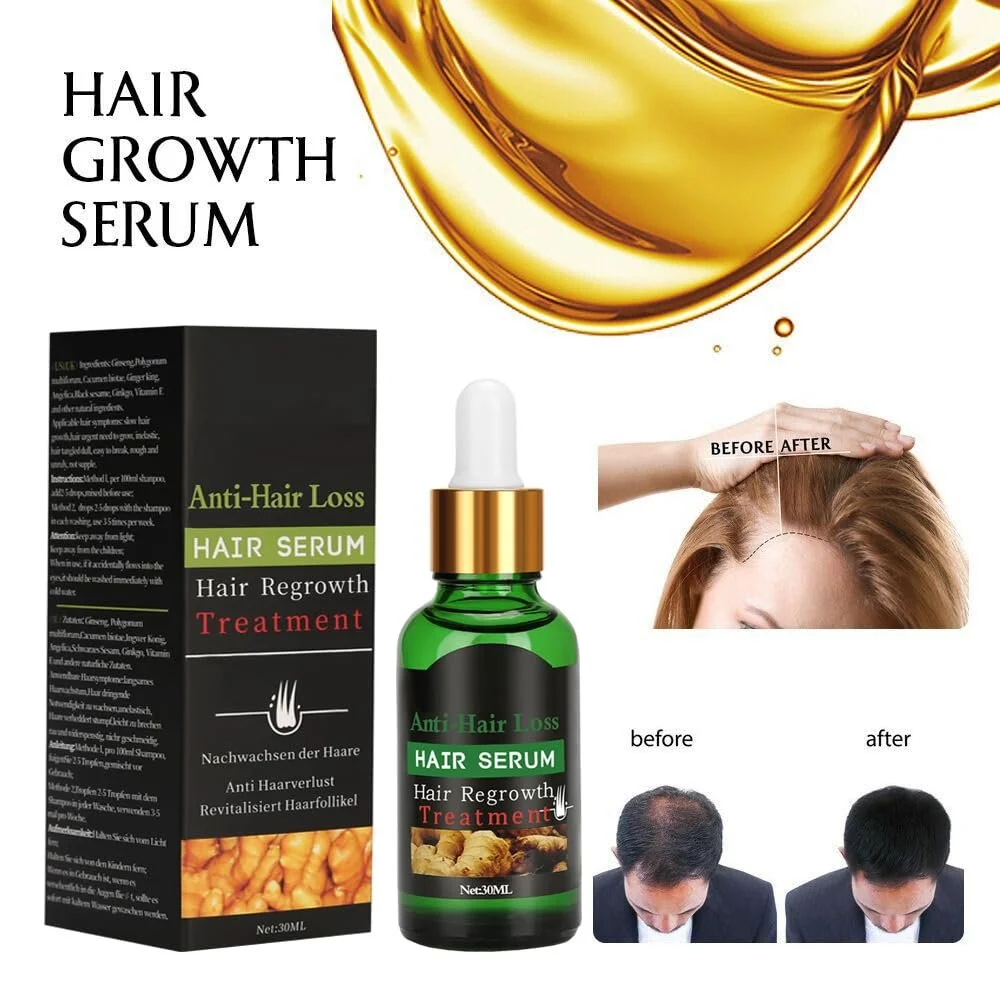 Мезоролер Youufangg з 2 наборами сироватки для росту волосся, проти випадіння волосся, фото №5 Мезоролер Youufangg з 2 наборами сироватки для росту волосся, проти випадіння волосся, фото №5