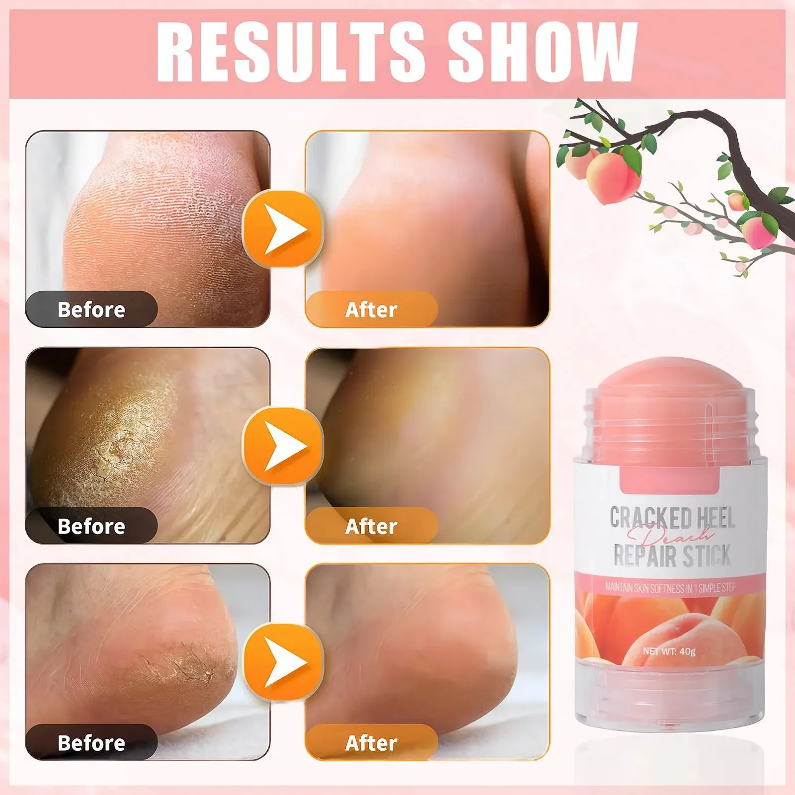 Крем для ног Hydrating Foot Cream увлажняющий против трещин 2 шт., фото №6