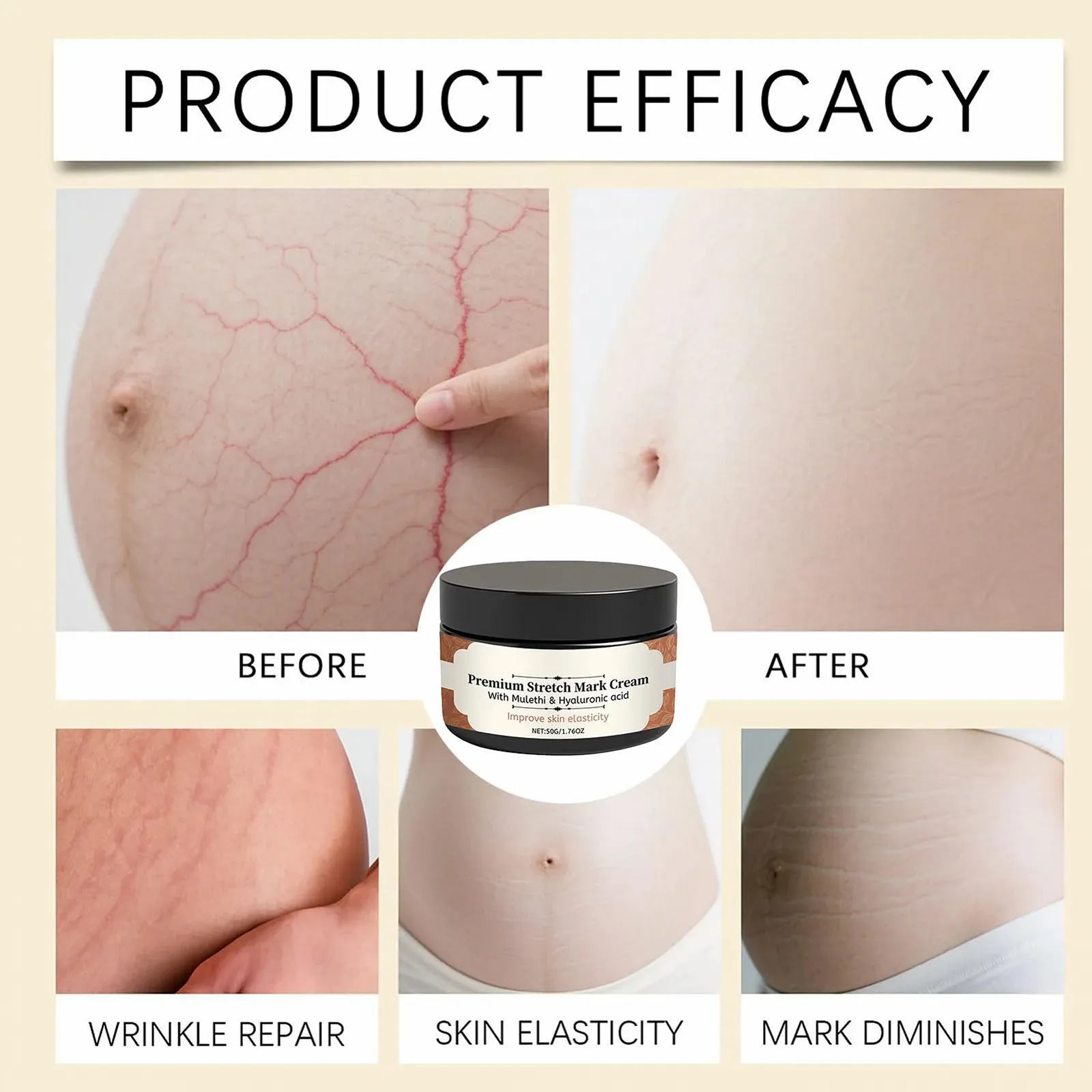 Крем от растяжек для беременных 50 г Крем для живота Обезжиривающий лосьон для беременных Предотвращает растяжки и улучшает эластичность, фото №4