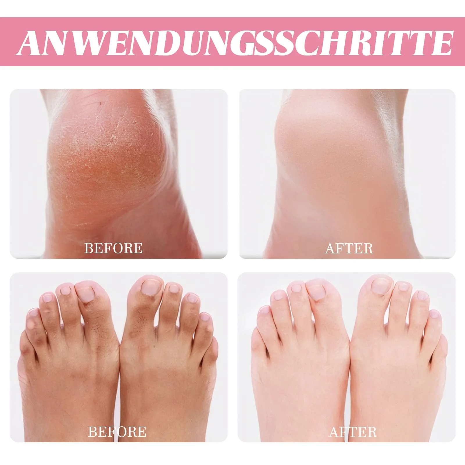 Крем-стик для ног Urea Repair Plus увлажняющий против трещин набор из 2 шт, фото №3