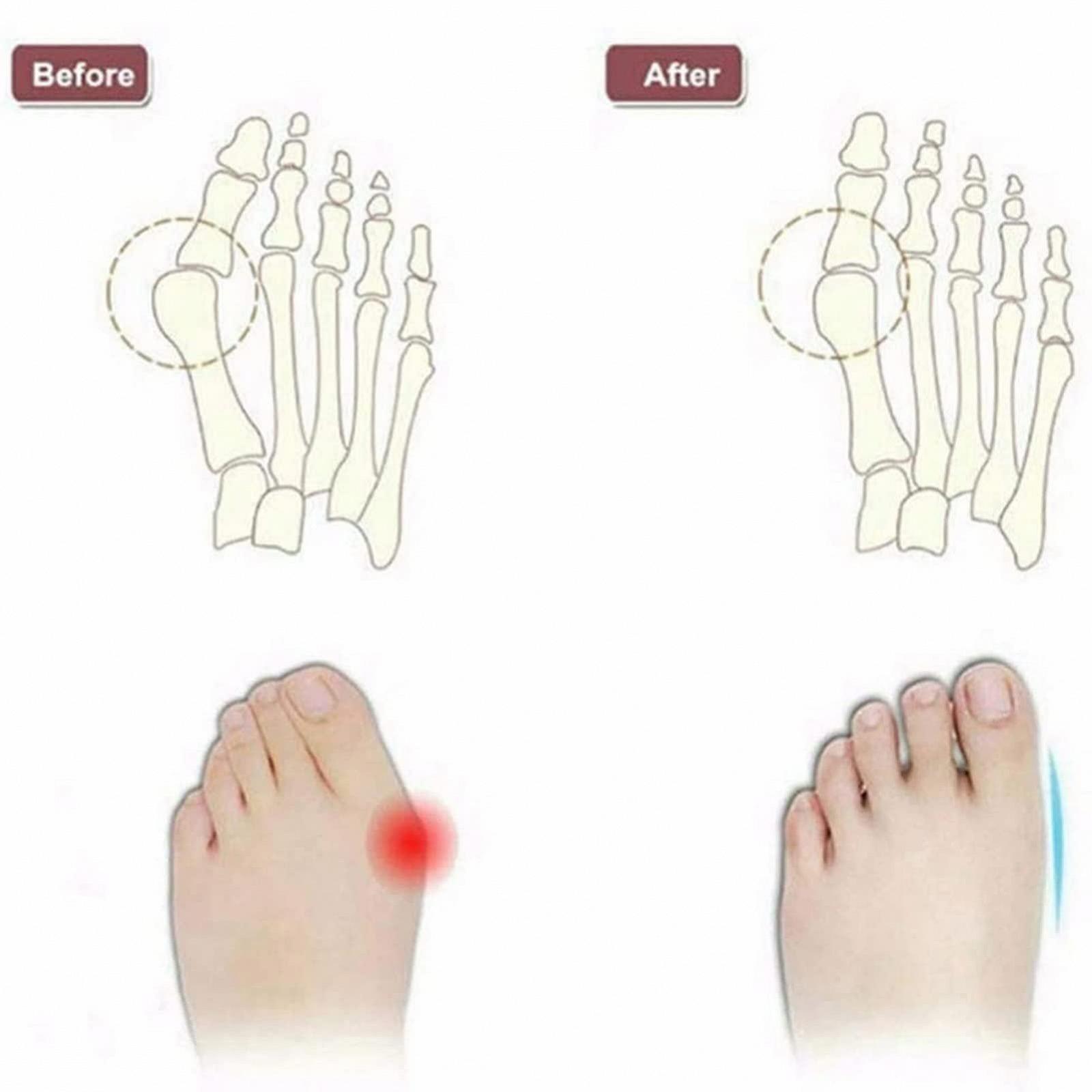 Женские Шлепанцы для коррекции стопы Золотой, фото №6