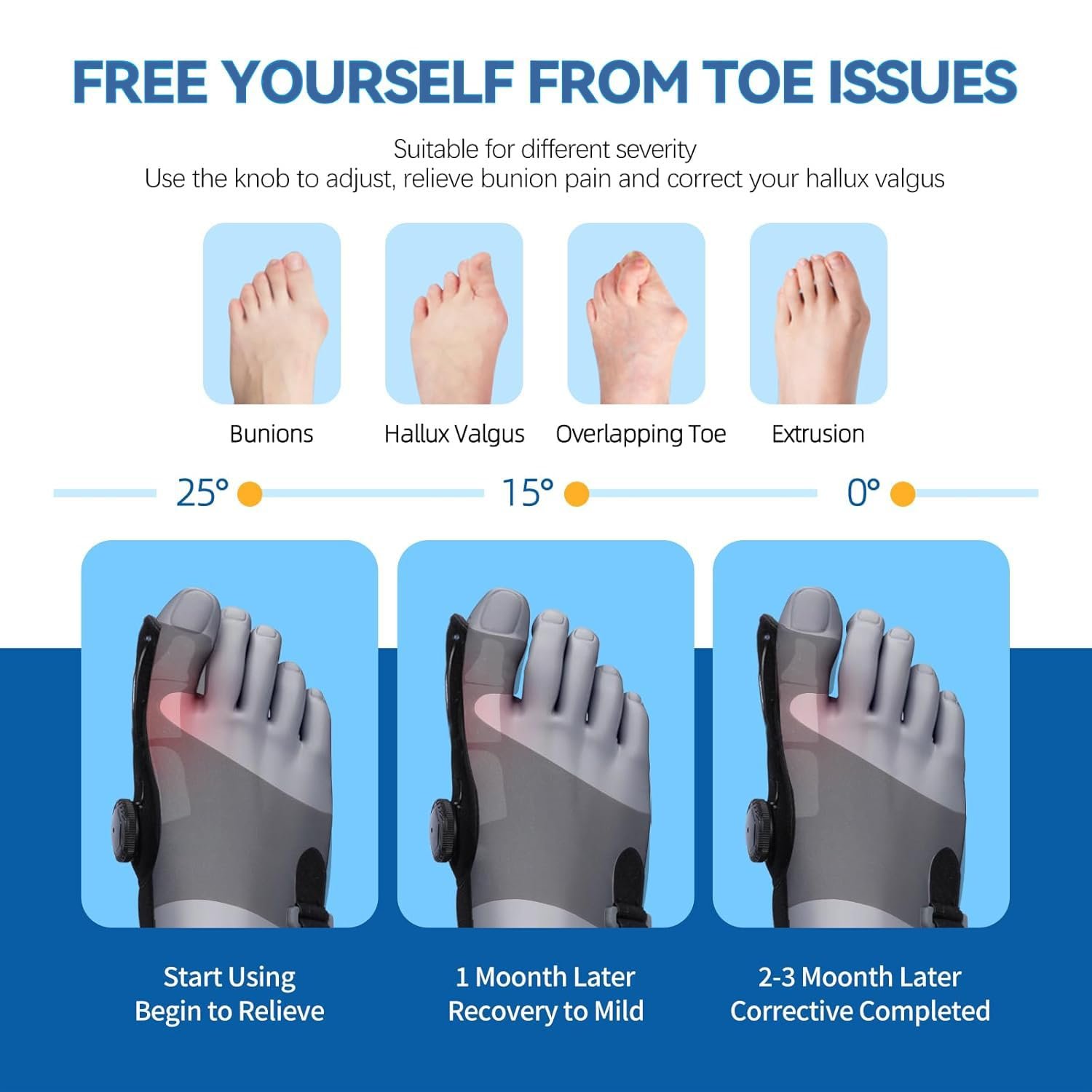 Коректор великого пальця стопи Qualihome з 2 кутовими роздільниками для пальців, фото №2