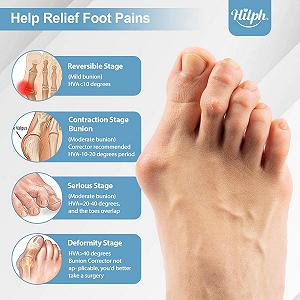 Роздільник для пальців ніг Hilph Hallux Valgus для чоловіків та жінок synthetic.ua - Фото 1