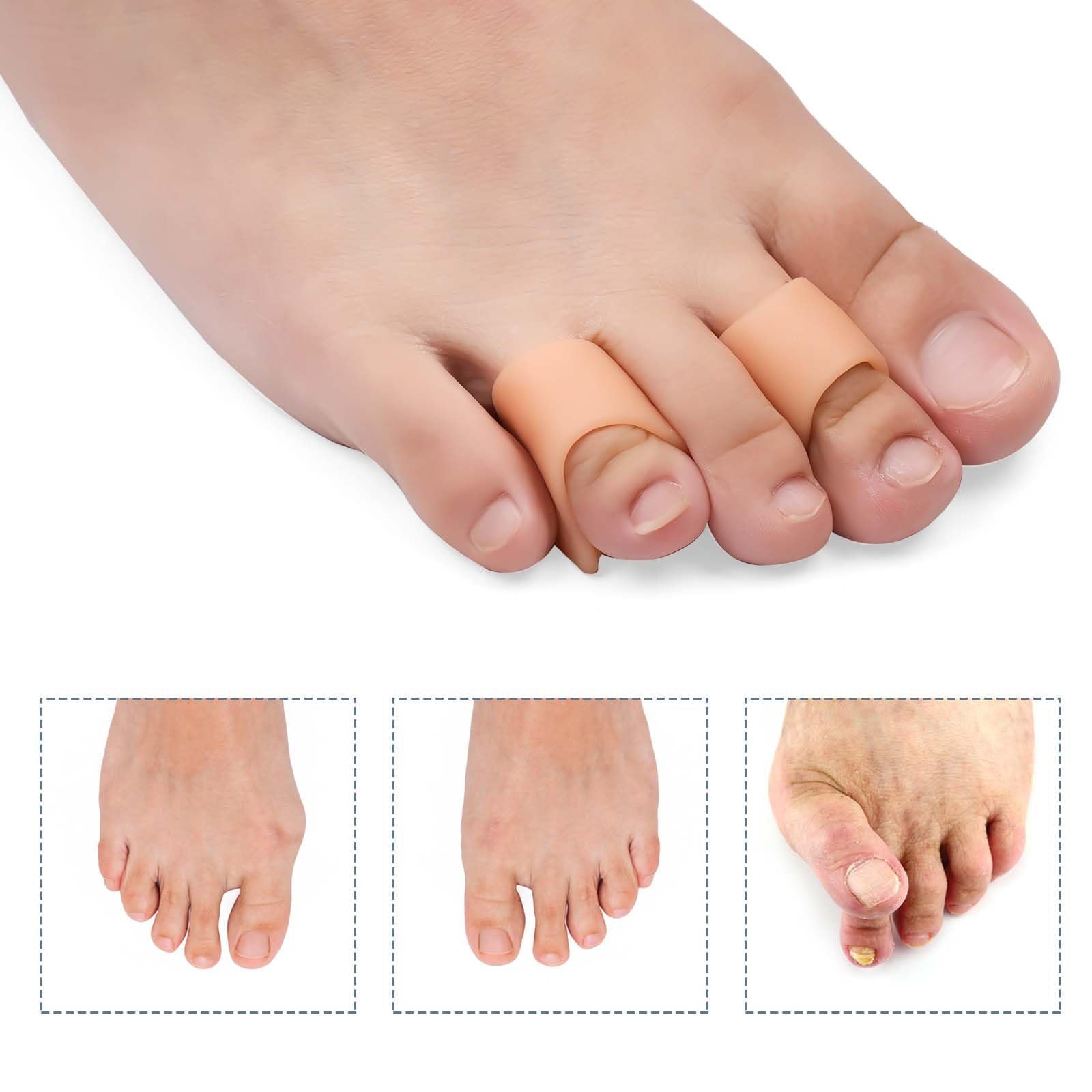 Випрямлячі для пальців ніг 6 шт., М’який гелевий коректор для випрямлення кривих пальців ніг (3 розміри), фото №6