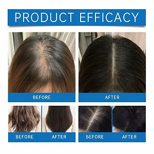 Ампула для волос Охлаждающая Sca/LP для роста волос, Сыворотка для волос против выпадения, Укрепление и рост волос synthetic.ua - Фото 1