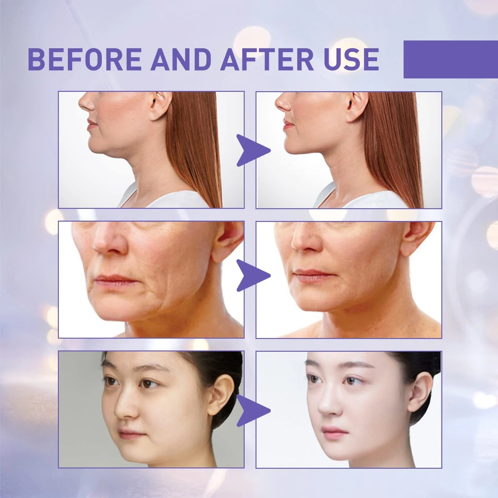 Стрічки для підтяжки обличчя Cynamus, наклейки для підтяжки обличчя, 40 штук в упаковці, фото №6