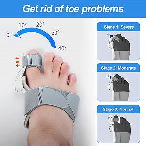 Шина для коррекции Hallux Valgus, регулируемая, для большого пальца ноги, для мужчин и женщин synthetic.ua - Фото 1