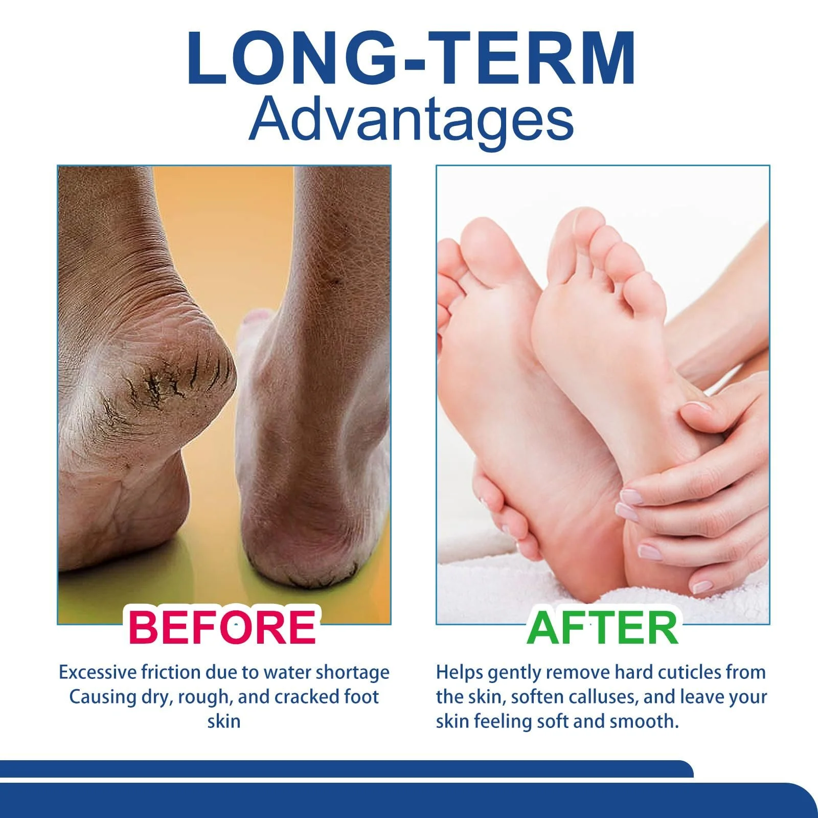 Крем для ног и рук Urea Cream 42% восстанавливающий для сухой и ороговевшей кожи 42%, фото №5