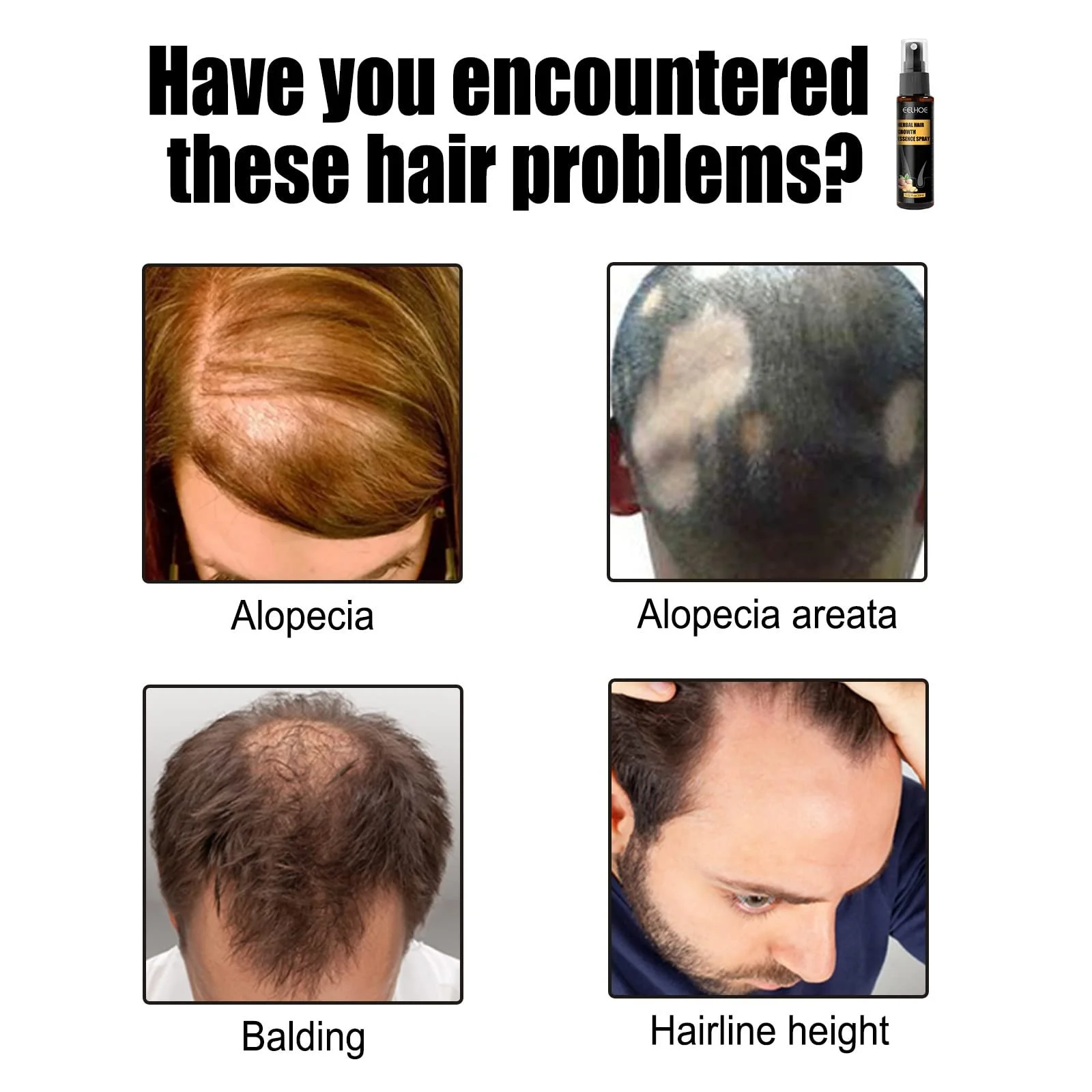 Есенція для волосся 2Hppsctink, для зміцнення коренів волосся, сироватка, 2 шт x 30 мл, шампунь, фото №5