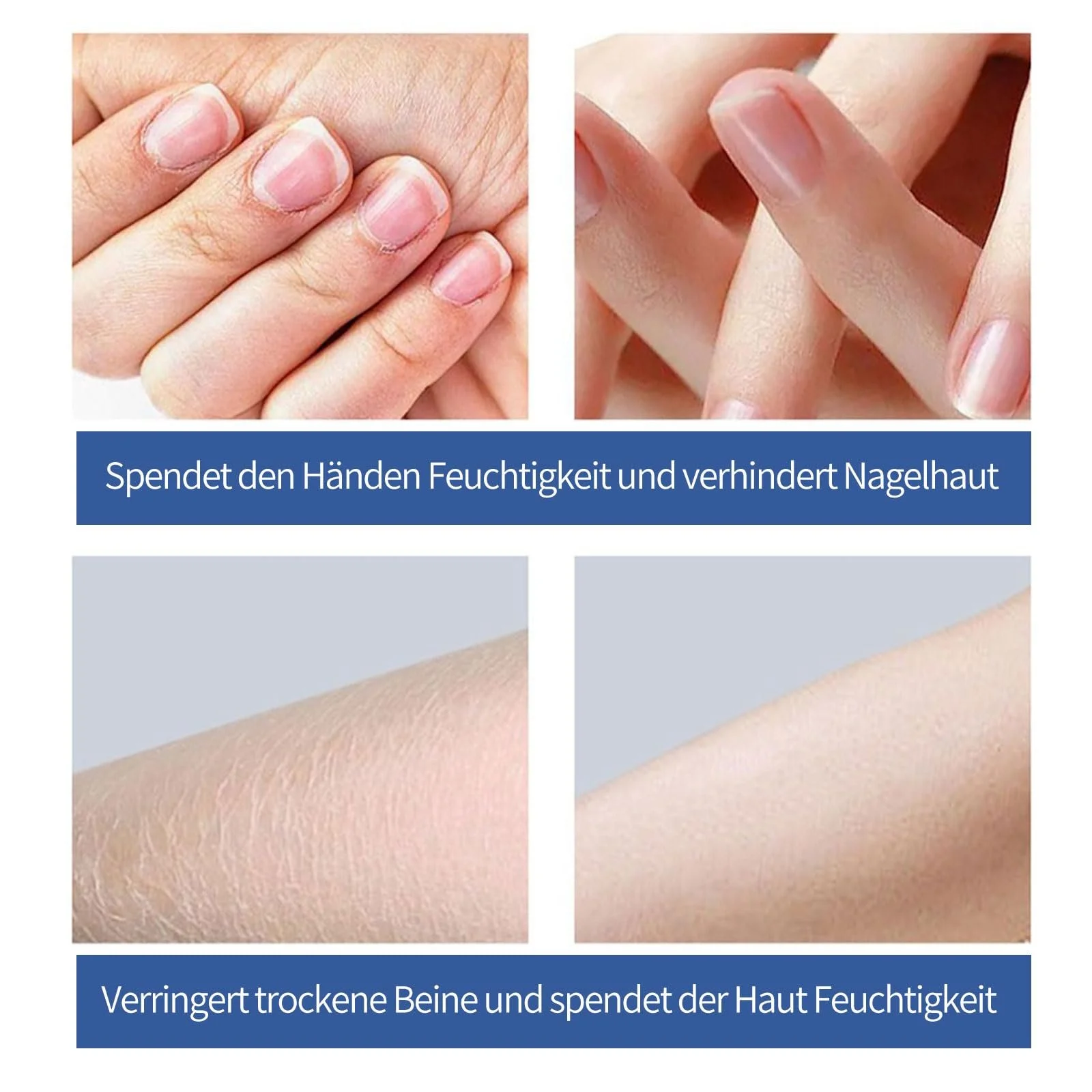 Крем для ног, рук и тела Urea Cream 40% сечовины для удаления мозолей и увлажнения, 150 г, фото №6