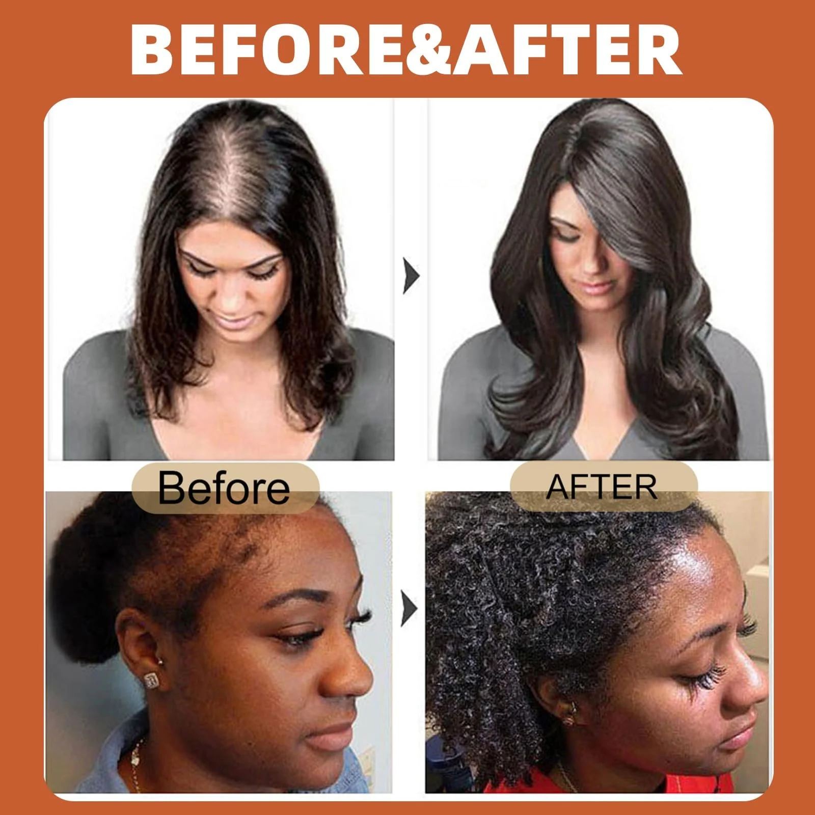 Олія Батани для Волосся, Олія для Росту Волосся, Натуральна, фото №3