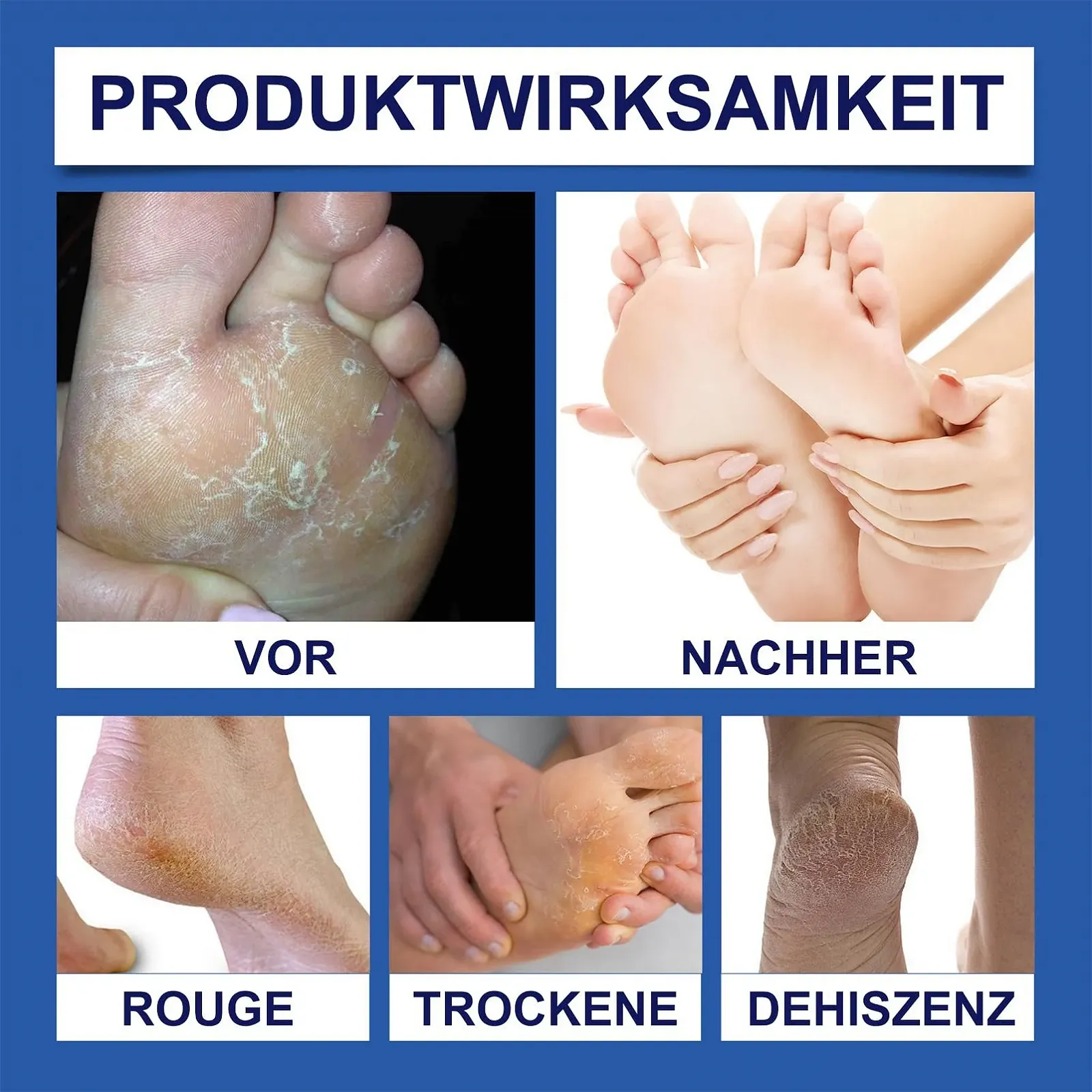 Крем-стик для ног Anti-Cracking с 60% мочевины увлажняющий 2 шт (80 г, Персик), фото №7