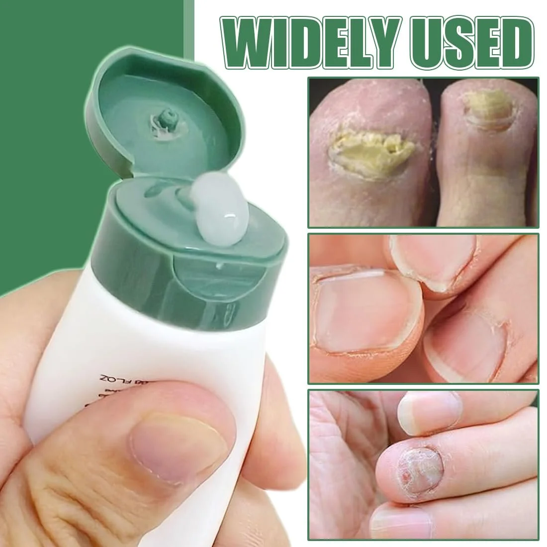 Многофункциональный гель для восстановления ногтей, Гель для лечения ногтей, Крем для ногтей (2 шт.), фото №5