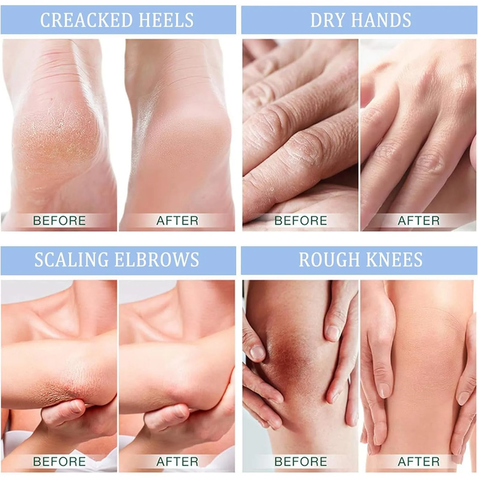 Крем для ног и рук с мочевиной 40% От мозолей и трещин 150 г, фото №6