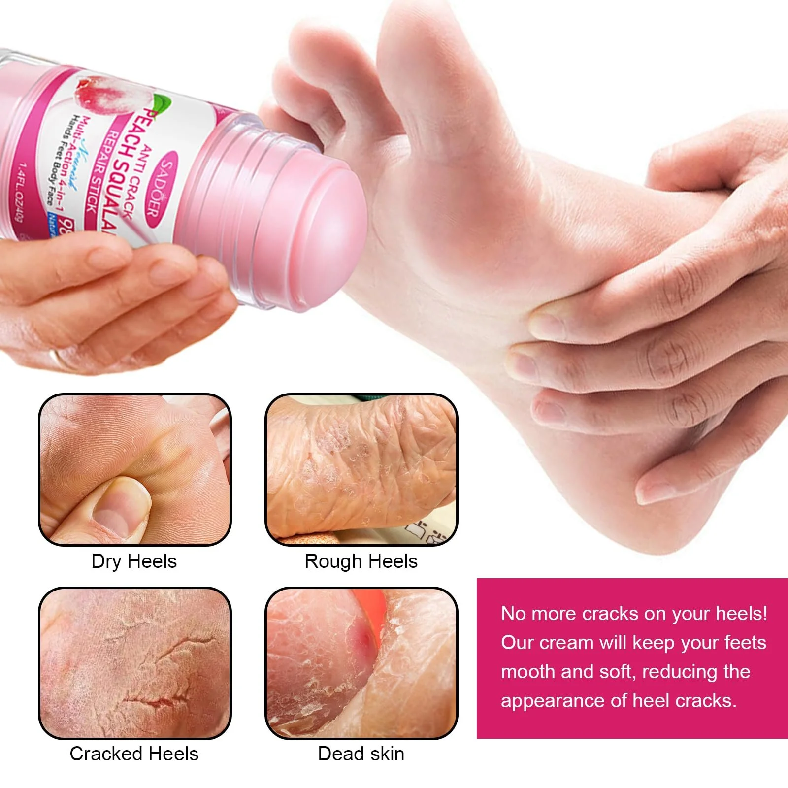 Крем для ног Набор 2 шт. для очень сухой кожи увлажняющий против трещин, фото №6
