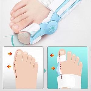 Випрямляч для пальців ніг при вальгусній деформації, коректор для жінок і чоловіків synthetic.ua - Фото 1